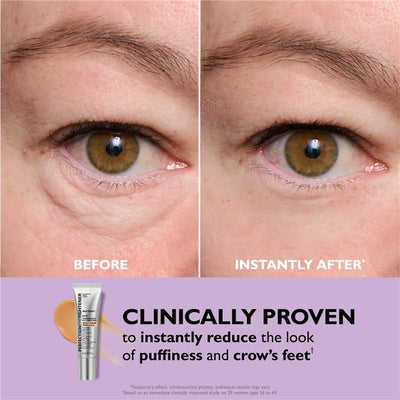 FirmX™ | instant eye lift