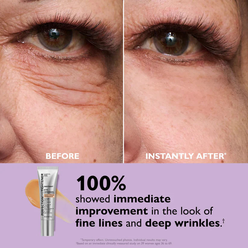 FirmX™ | instant eye lift