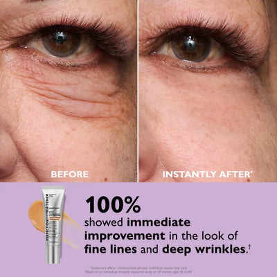 FirmX™ | instant eye lift