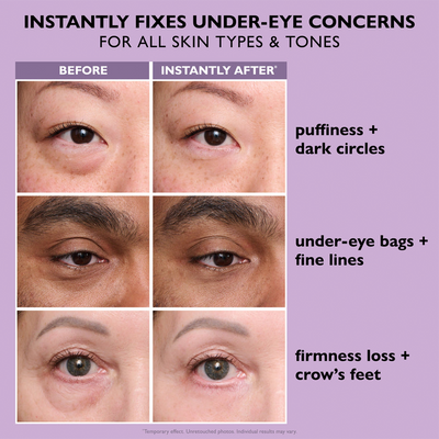 FirmX™ | instant eye lift