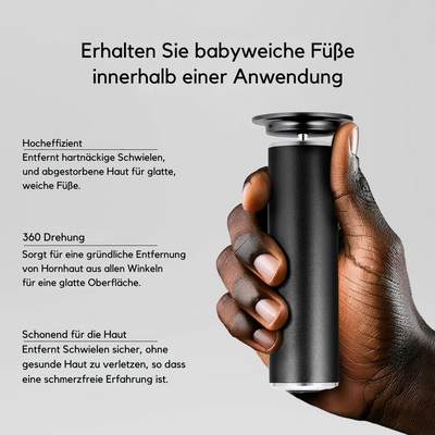 Suaveza™ | Elektrischer Hornhautentferner