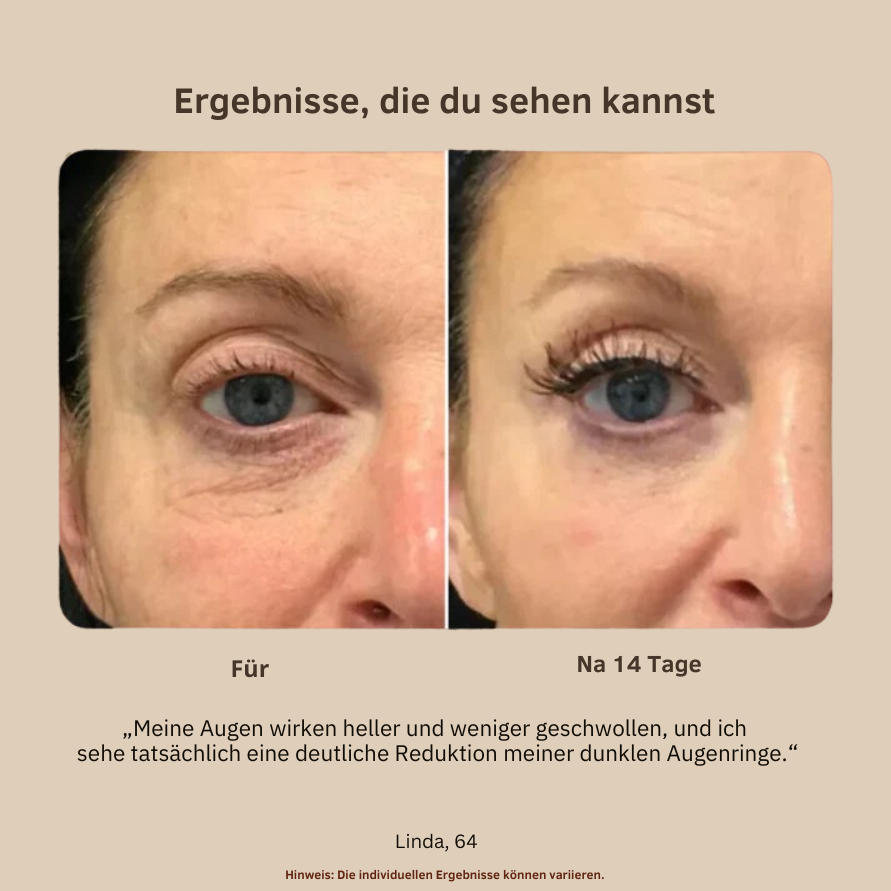 UnderGlow™ | Jugendlicher Glow