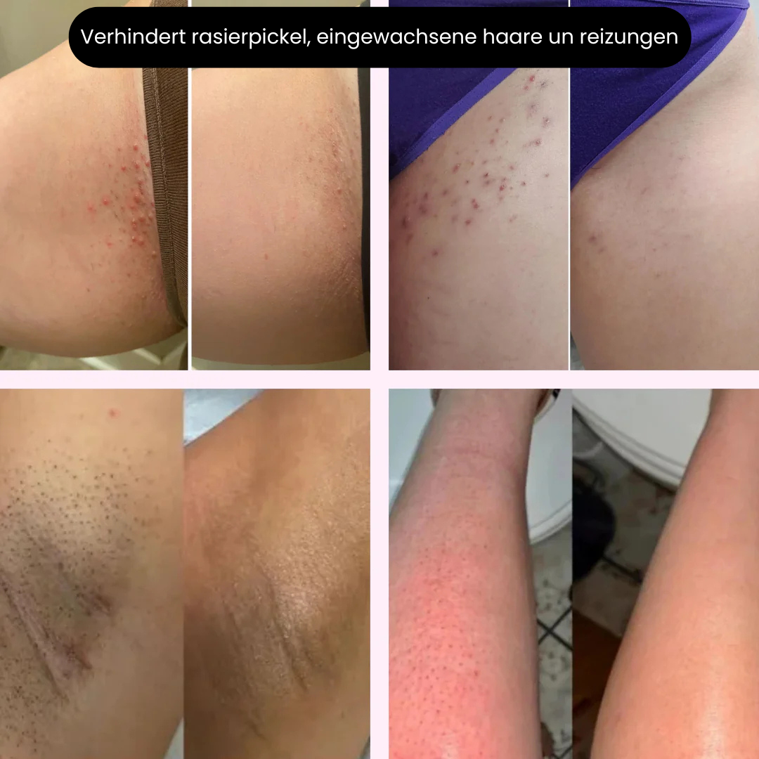 SilkEase™ | Glatt ohne Irritation